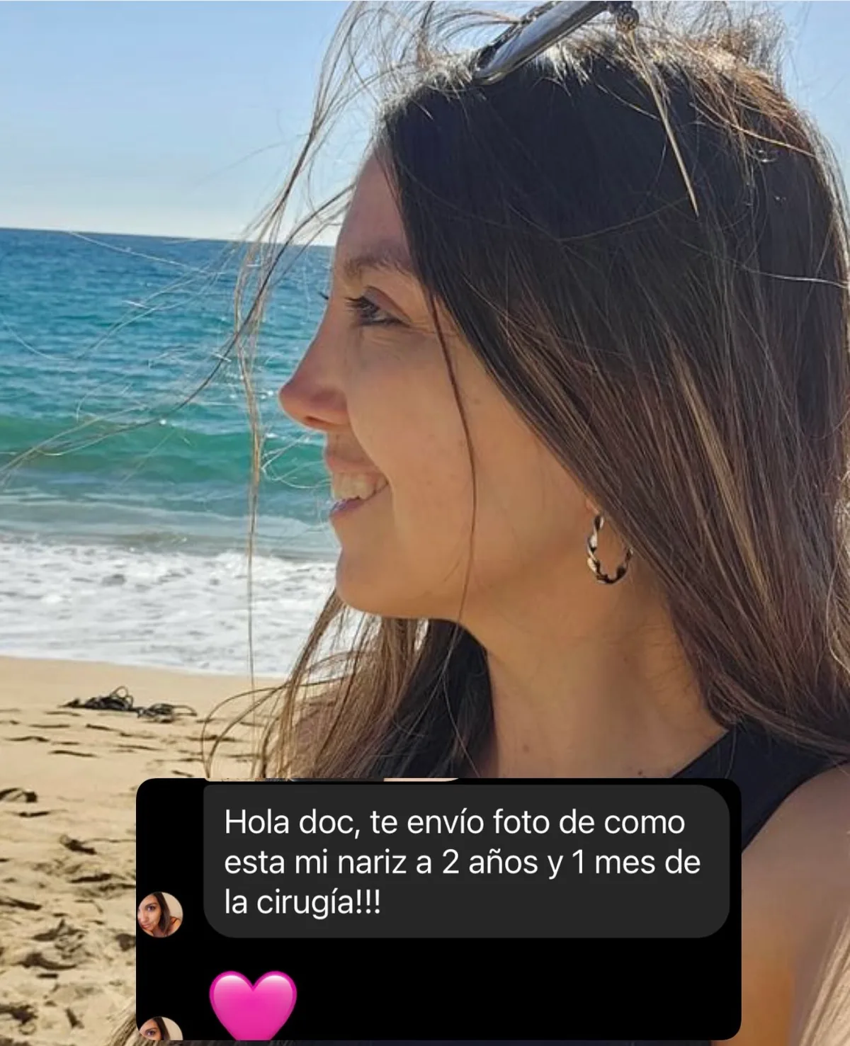 Testimonio de paciente en Instagram (1)