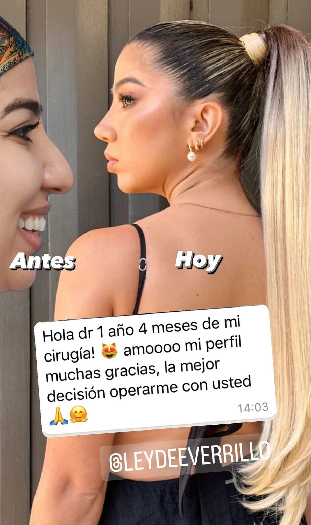 Testimonio de paciente en Instagram (15)