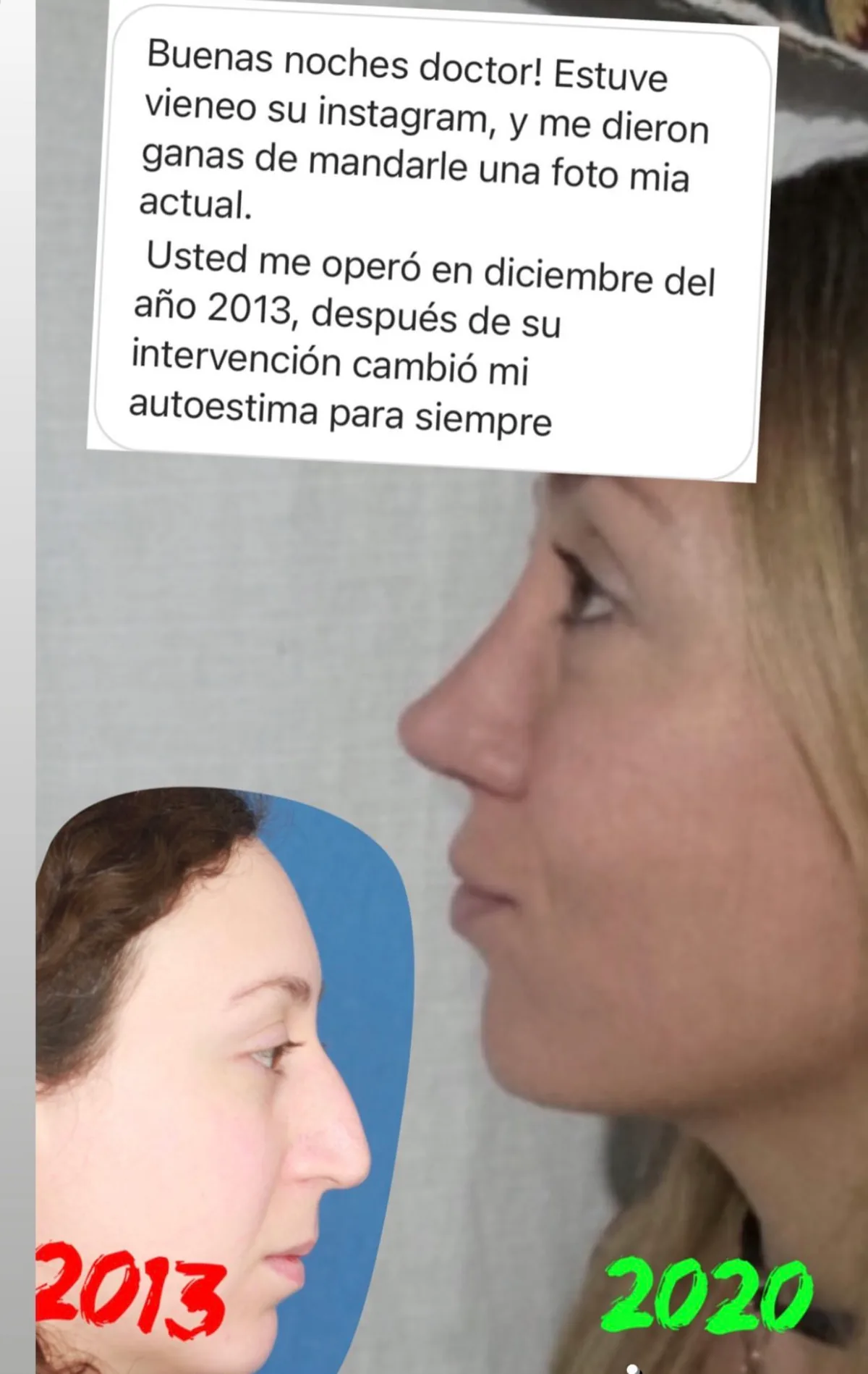 Testimonio de paciente en Instagram (23)