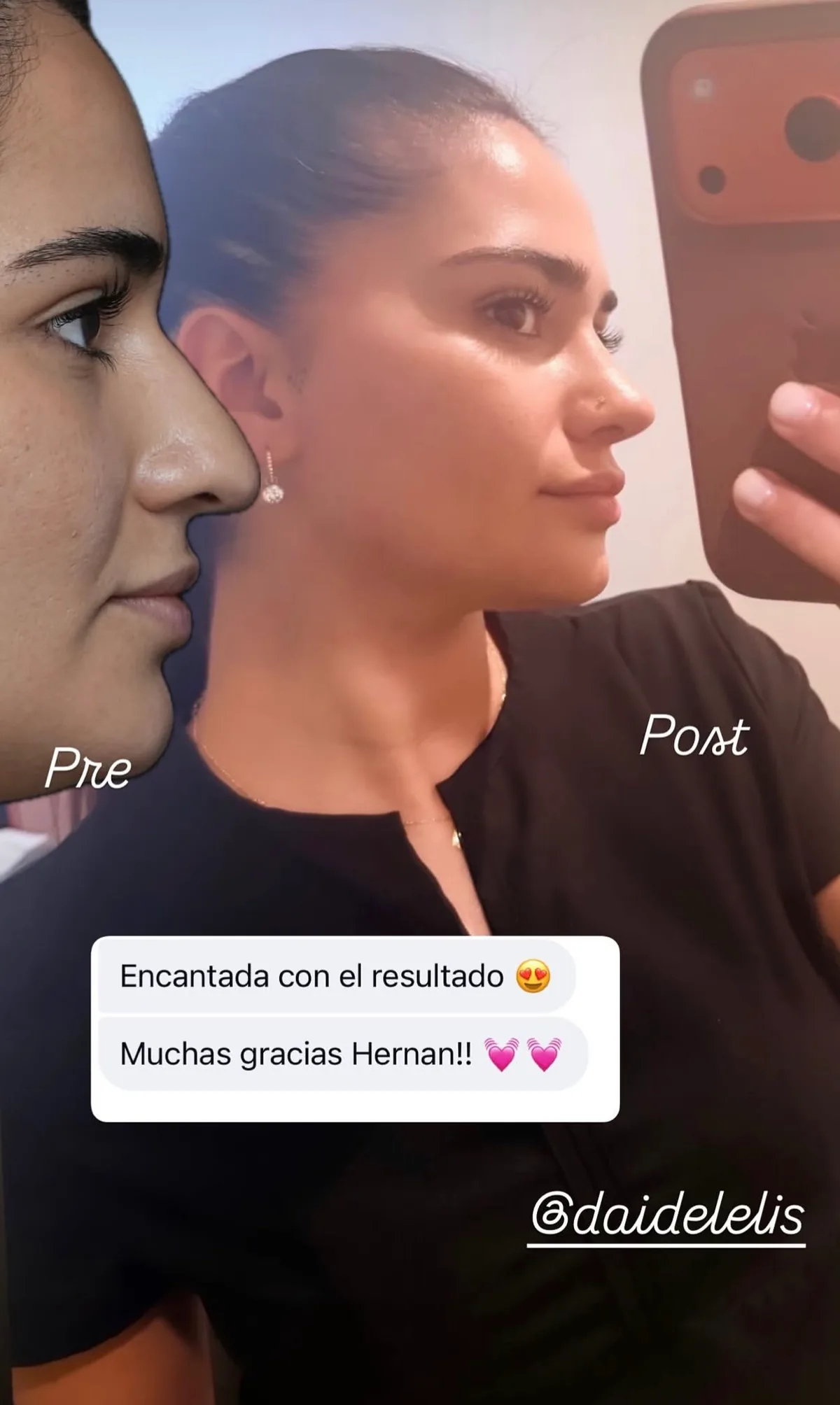 Testimonio de paciente en Instagram (27)