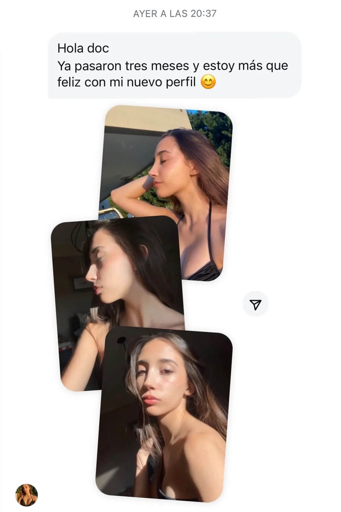 Testimonio de paciente en Instagram (7)